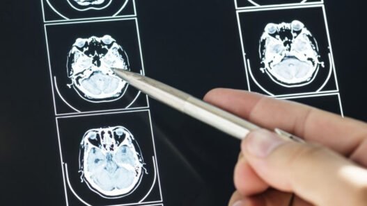 brain injury