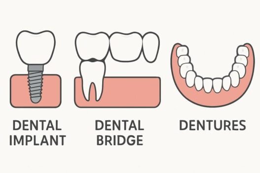comparing dental implants and other tooth replacement options