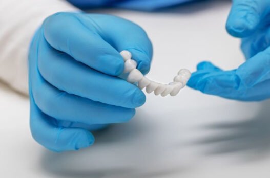 5 daily care tips for implant supported bridges