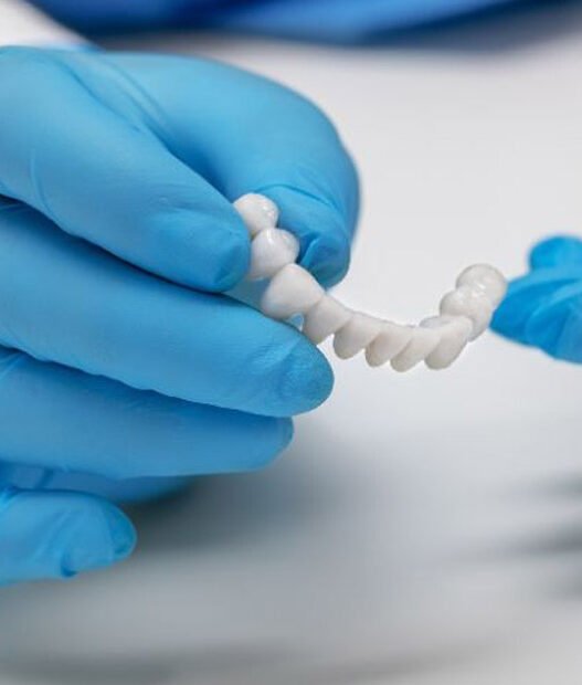 5 daily care tips for implant supported bridges