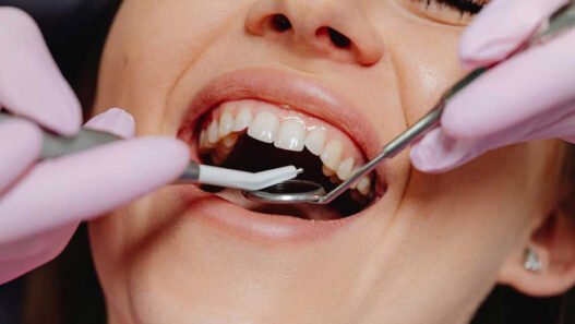 how general dentistry helps manage gum health over time