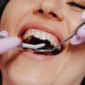 how general dentistry helps manage gum health over time