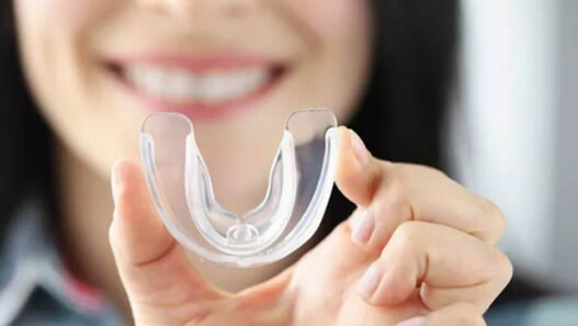 how general dentists customize night guards for tooth protection