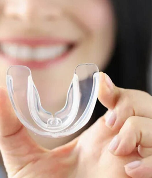 how general dentists customize night guards for tooth protection