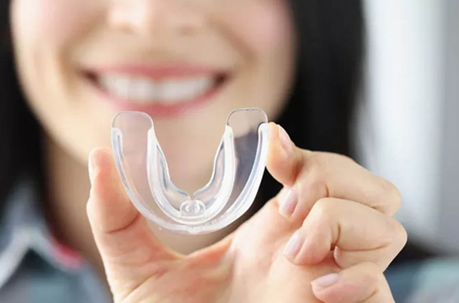 how general dentists customize night guards for tooth protection