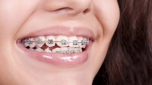 the connection between family dentistry and early orthodontic care