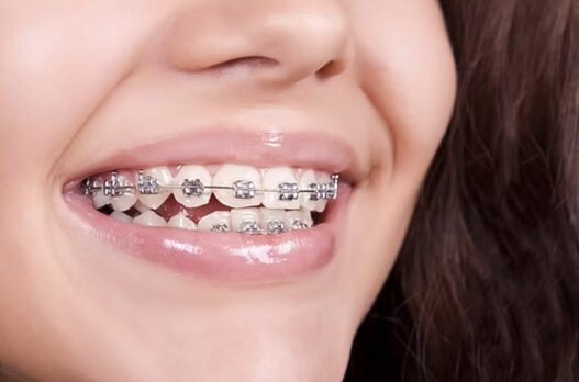 the connection between family dentistry and early orthodontic care