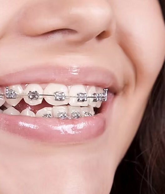 the connection between family dentistry and early orthodontic care