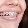 the connection between family dentistry and early orthodontic care