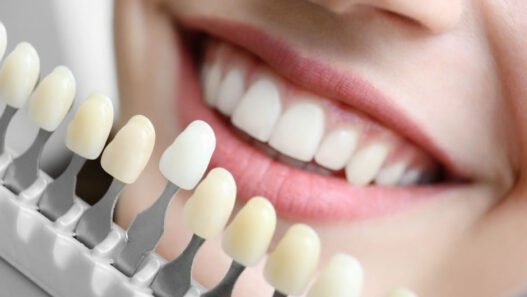 faqs about cosmetic dentistry answered