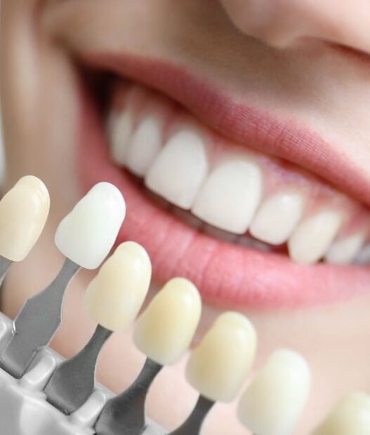 faqs about cosmetic dentistry answered