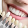 faqs about cosmetic dentistry answered
