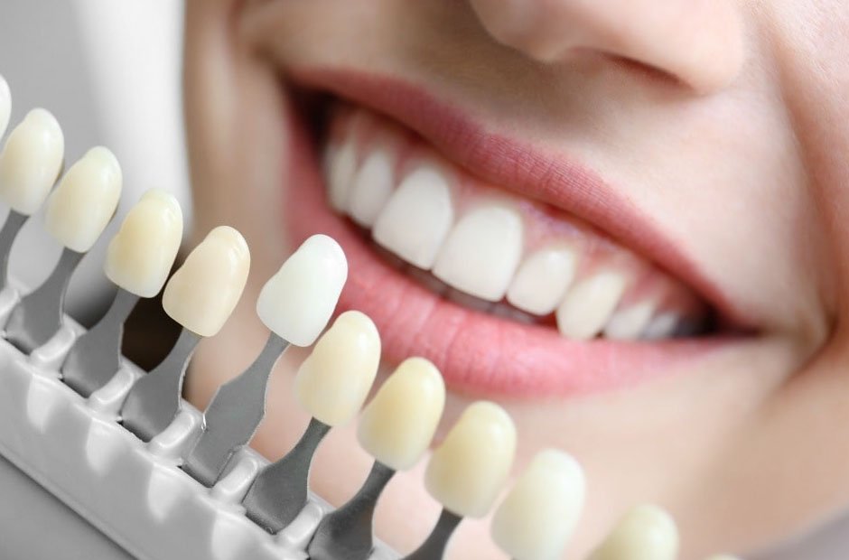 faqs about cosmetic dentistry answered