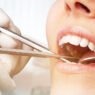 periodontal care