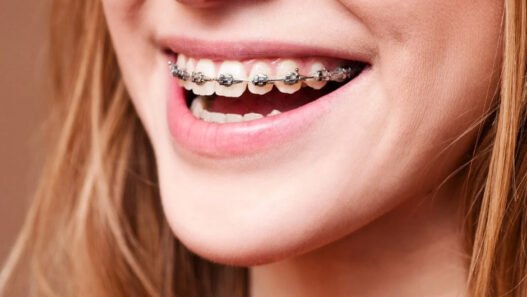 how orthodontic services influence speech and jaw development