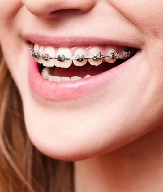 how orthodontic services influence speech and jaw development