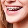 how orthodontic services influence speech and jaw development
