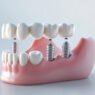 4 restorative dentistry options to replace missing teeth