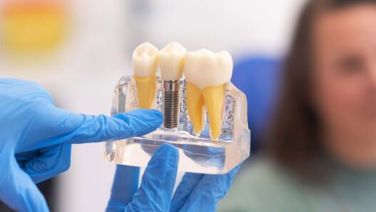5 benefits of dental implants in restorative dentistry