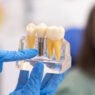 5 benefits of dental implants in restorative dentistry