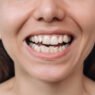6 common causes of uneven smiles and how dentists correct them